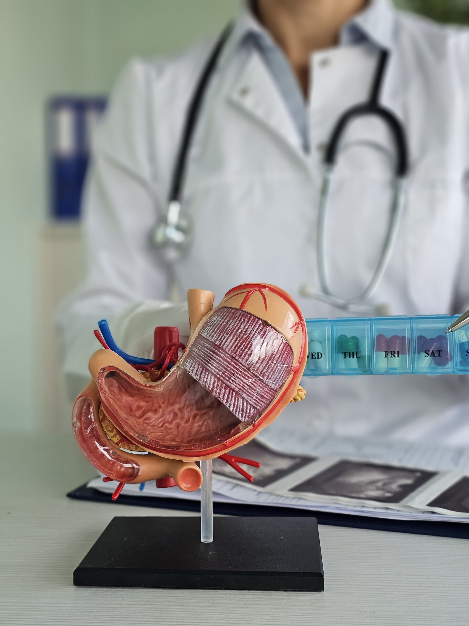 Doctor anatomy stomach holds pills. Pills for stomach concept