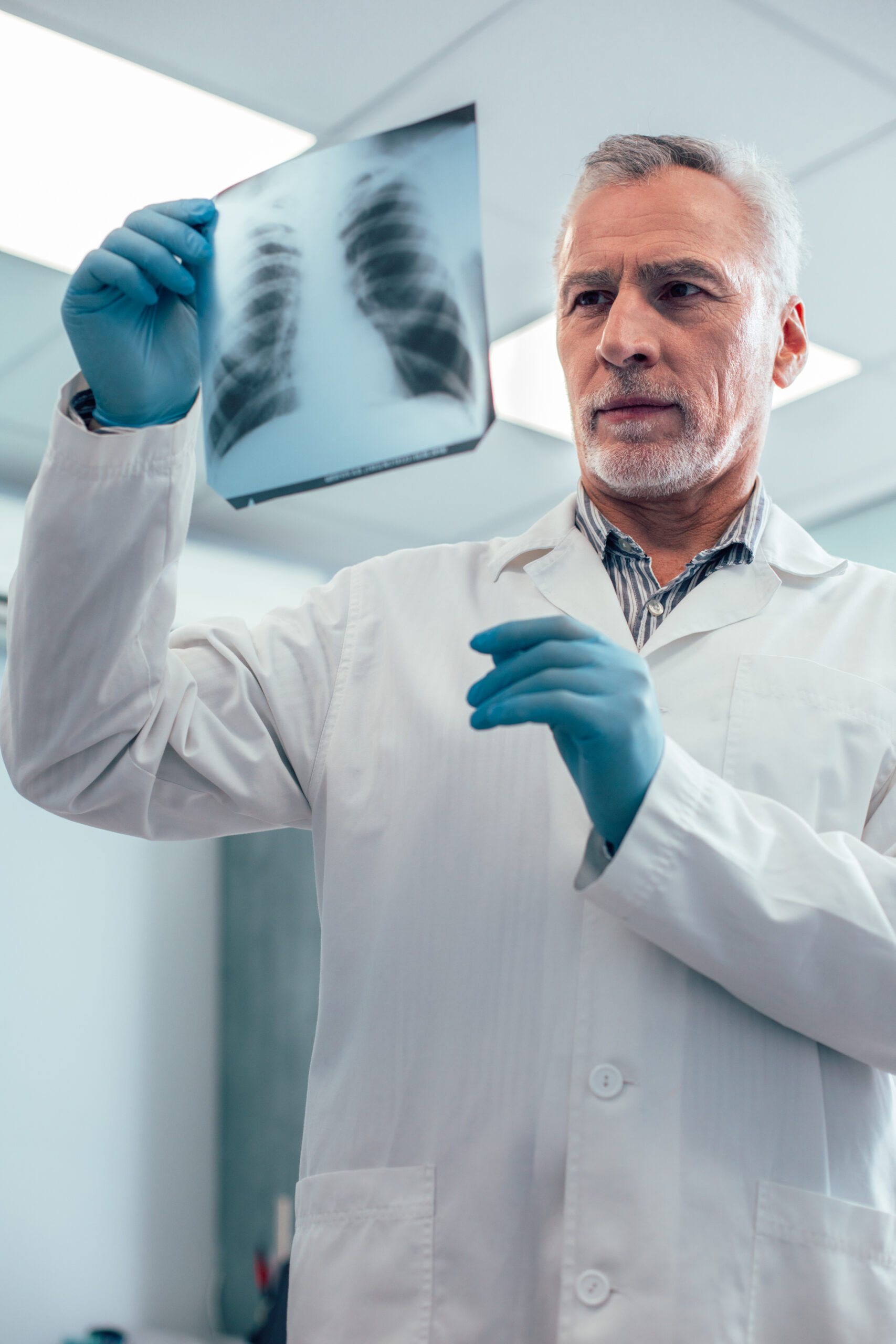 Serious doctor looking at the results of x-ray stock photo